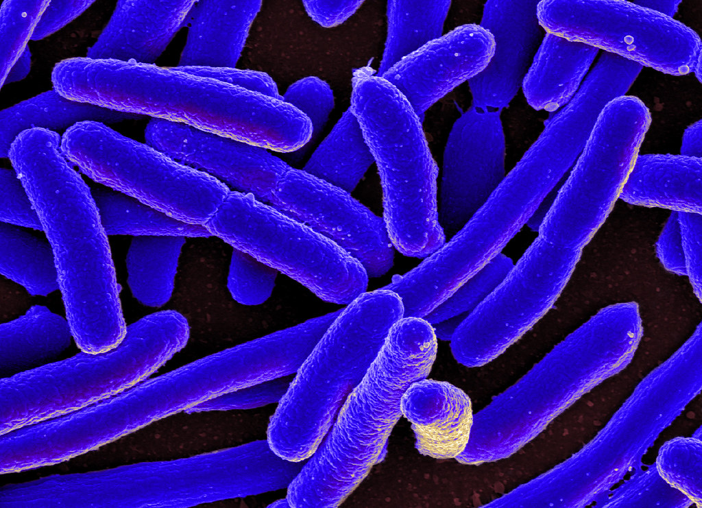 Scanning electron micrograph of Escherichia coli, a common gut bacterium
