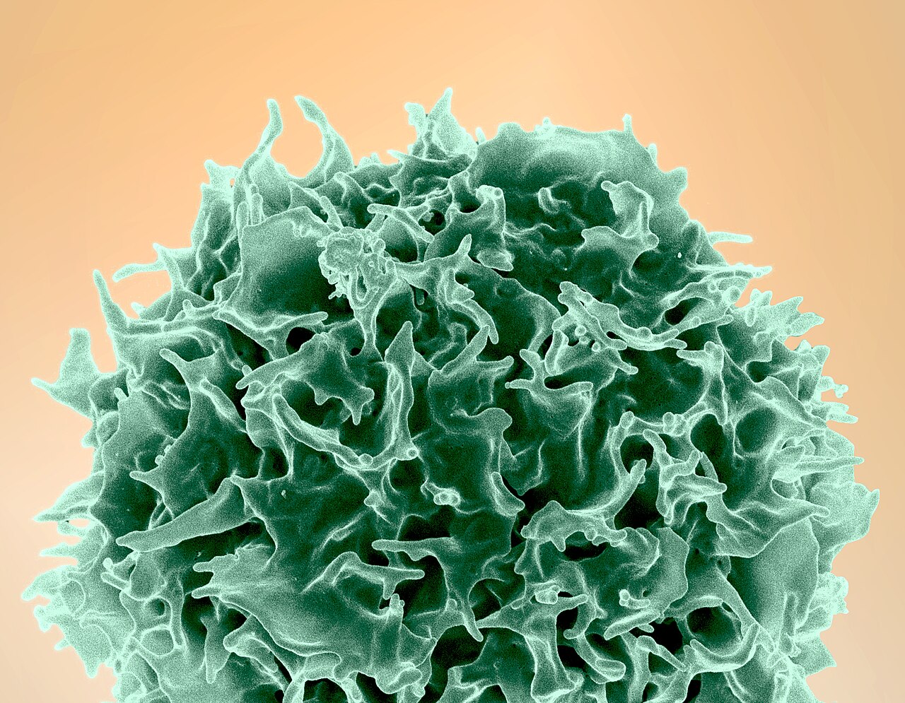 Colorized scanning electron micrograph of a T lymphocyte
