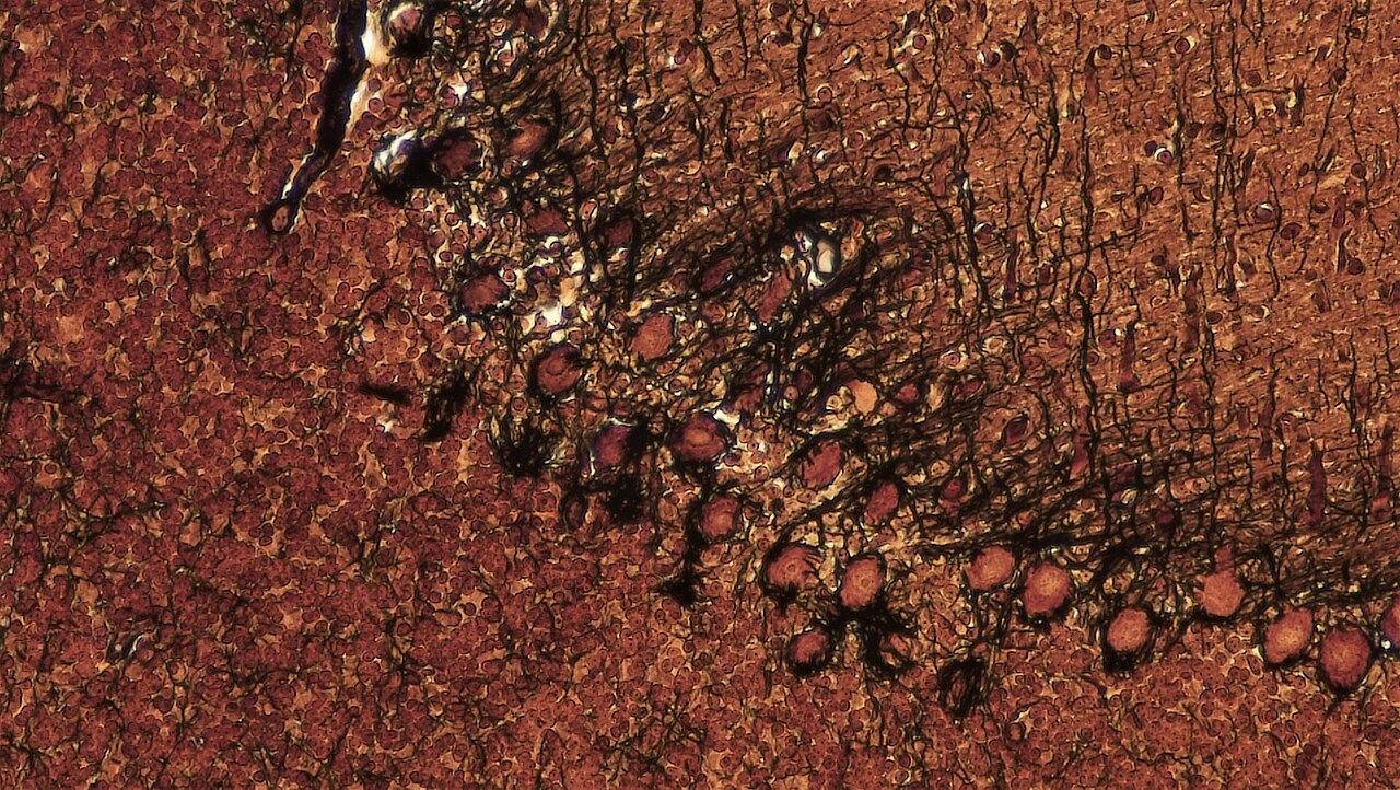 Silver-stained cross section of cerebellum showing Purkinje cells and their branching dendrites