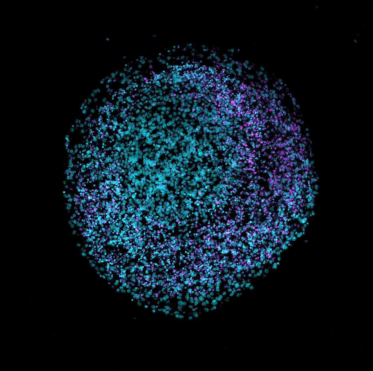Fluorescence cryosection of a human brain organoid with cell nuclei stained teal and a neuronal marker in magenta
