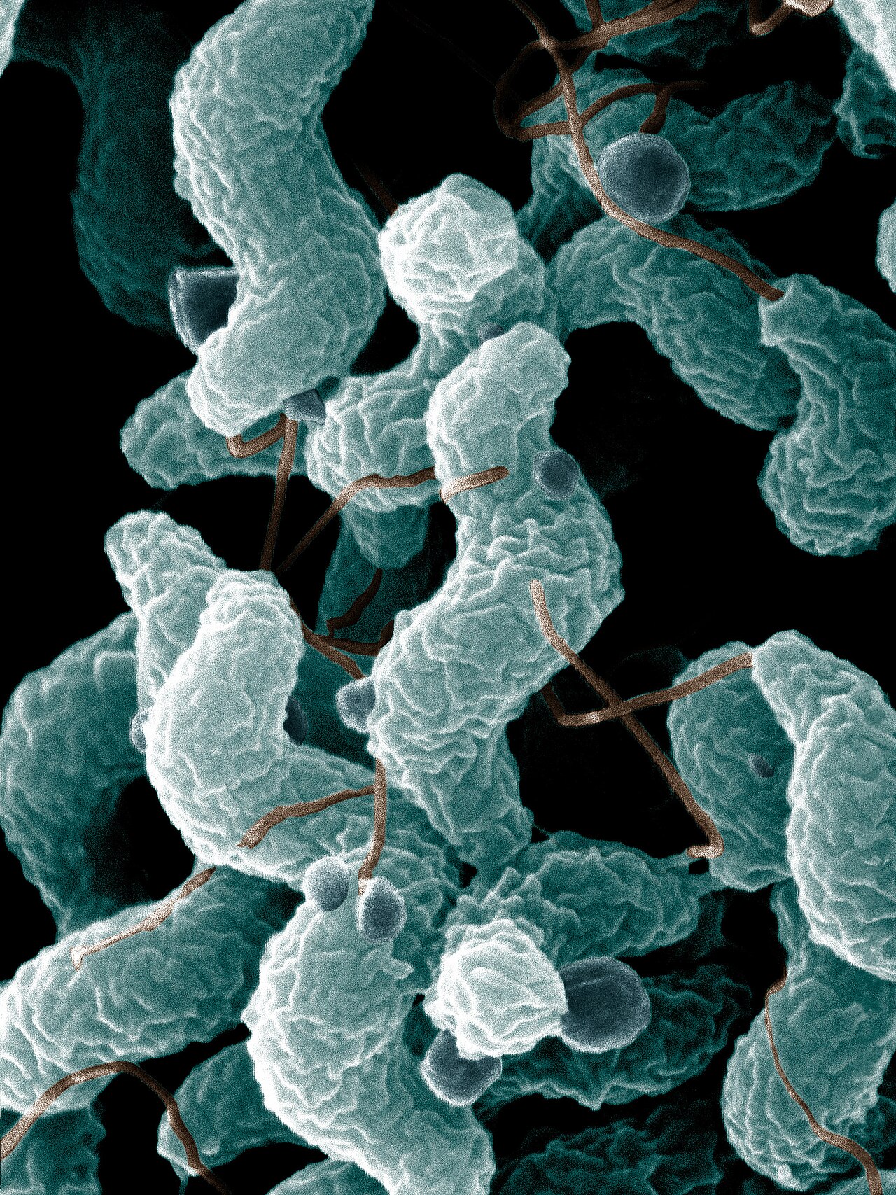 Electron micrograph of curved, spiral-shaped Campylobacter jejuni bacteria