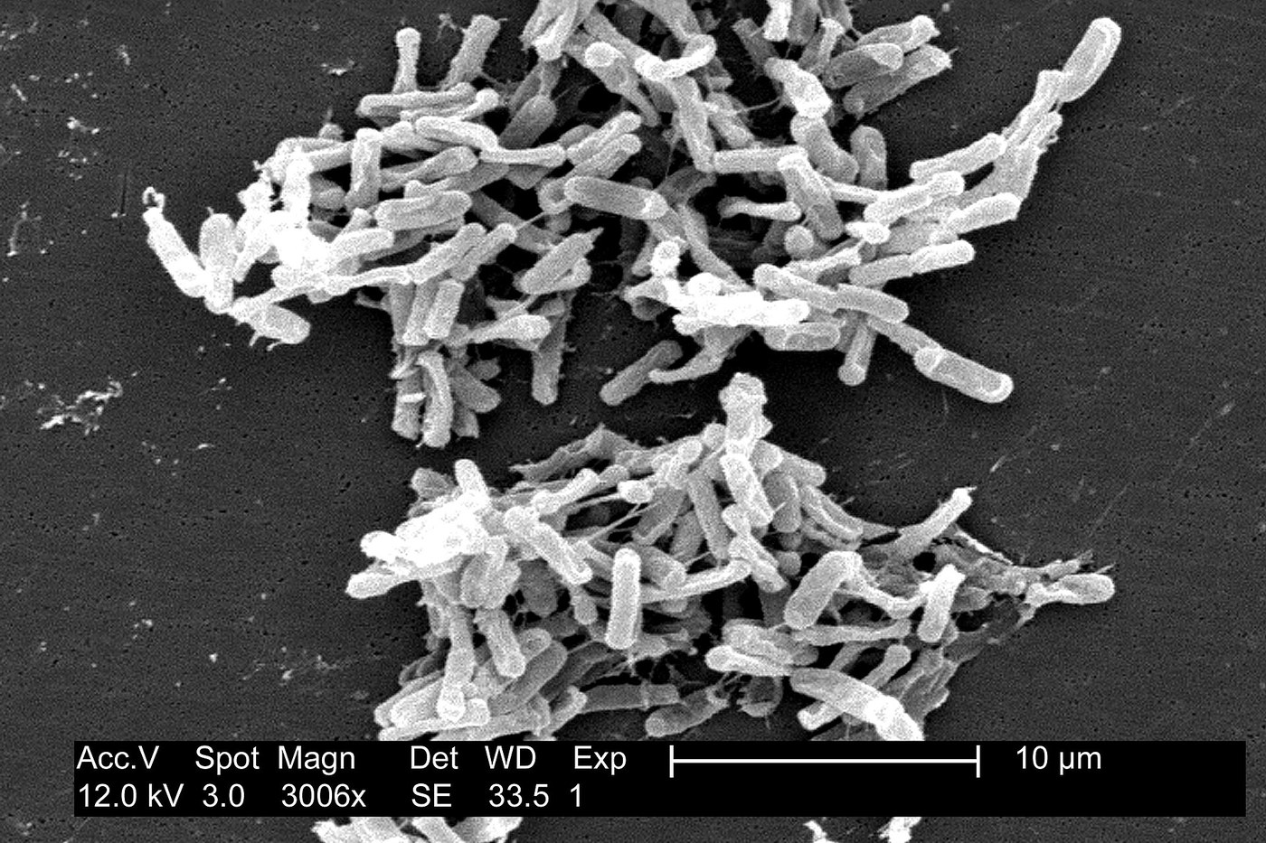 Electron micrograph of rod-shaped Clostridium bacteria