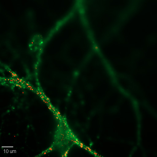 Fluorescence micrograph of a cultured mouse cortical neuron with synapses labelled for presynaptic and postsynaptic proteins