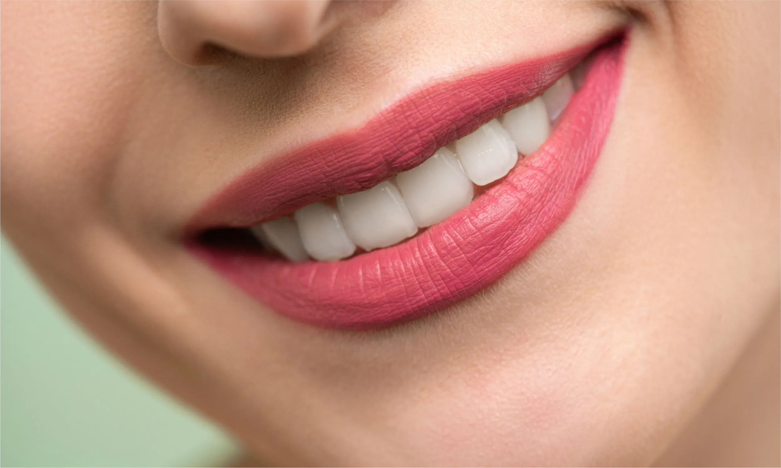 smile - after