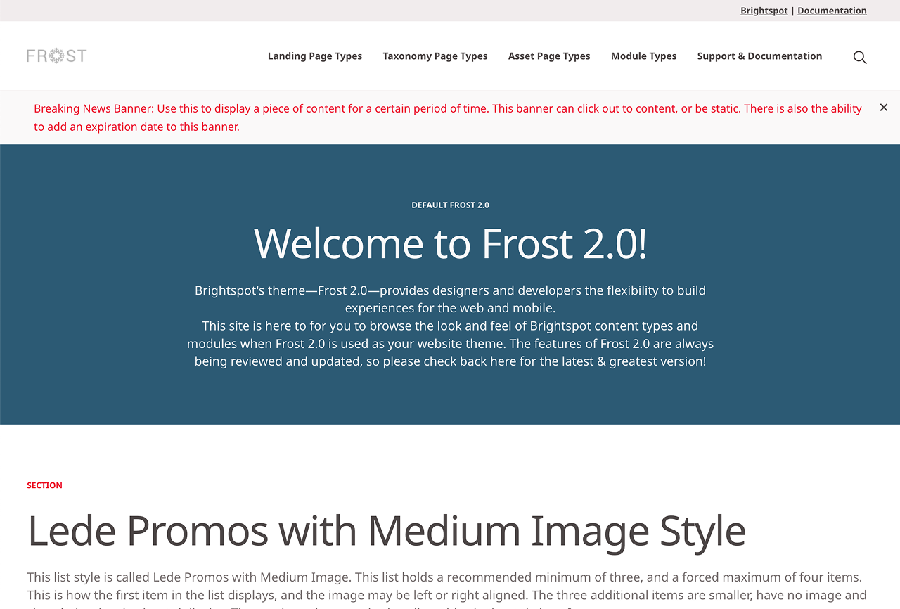 Brightspot Display Site which shows the Brightspot theme Frost 2.0 and lets viewers interact with their modules and content types.