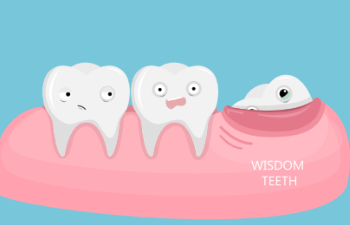 What’s The Wisdom of Wisdom Teeth?
