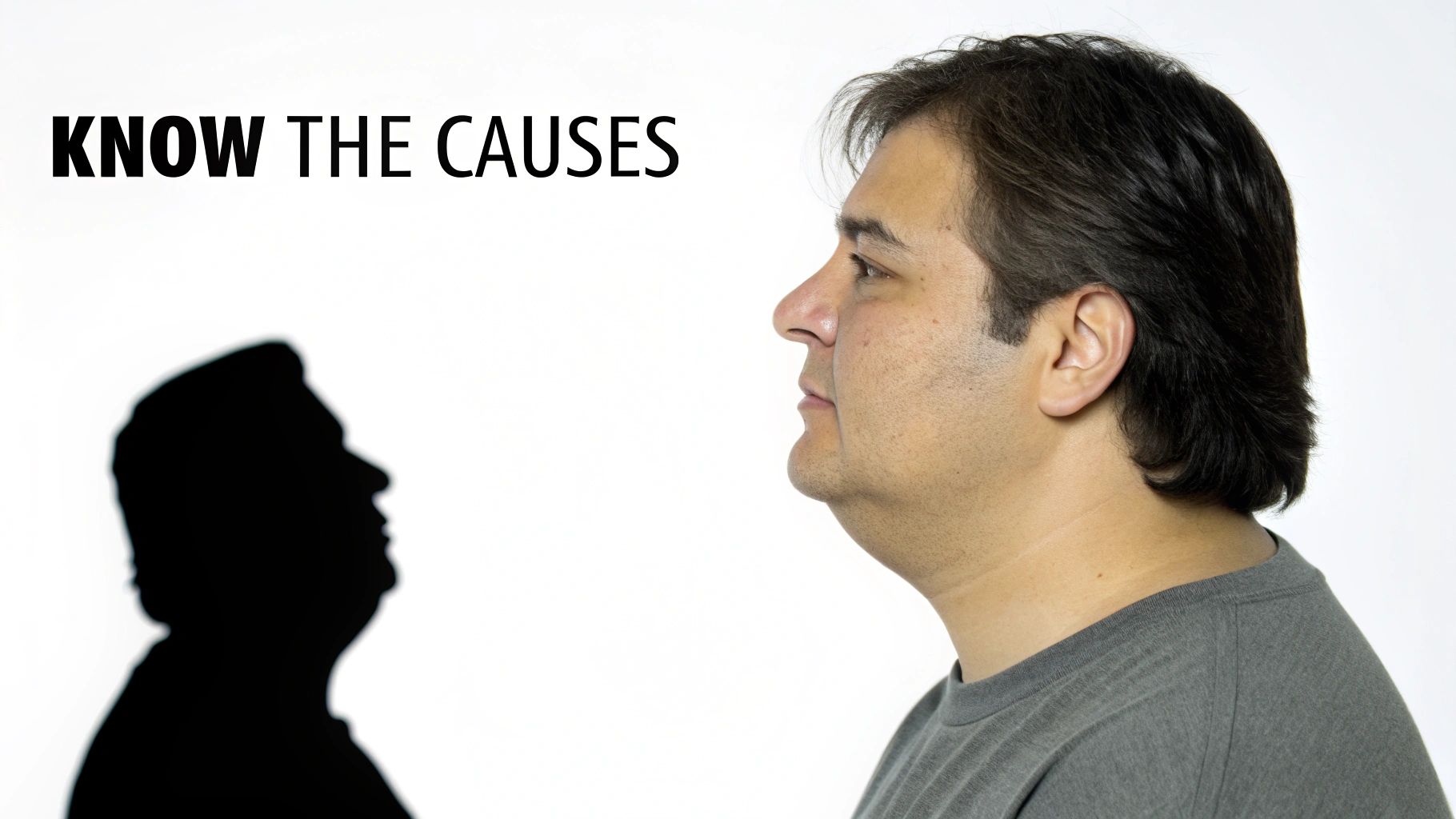 Profile view of a man with a prominent double chin and text 'KNOW THE CAUSES'.