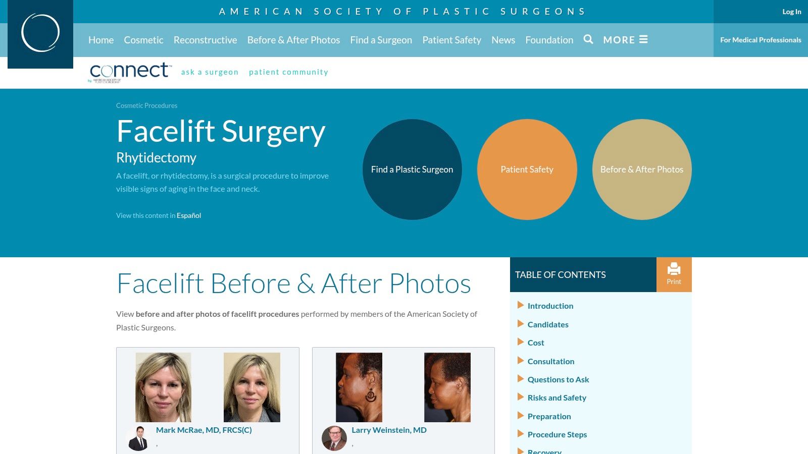 American Society of Plastic Surgeons (ASPS) – Before & After Photos