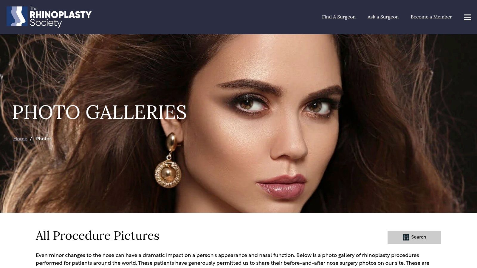 The Rhinoplasty Society – Before & After Photos