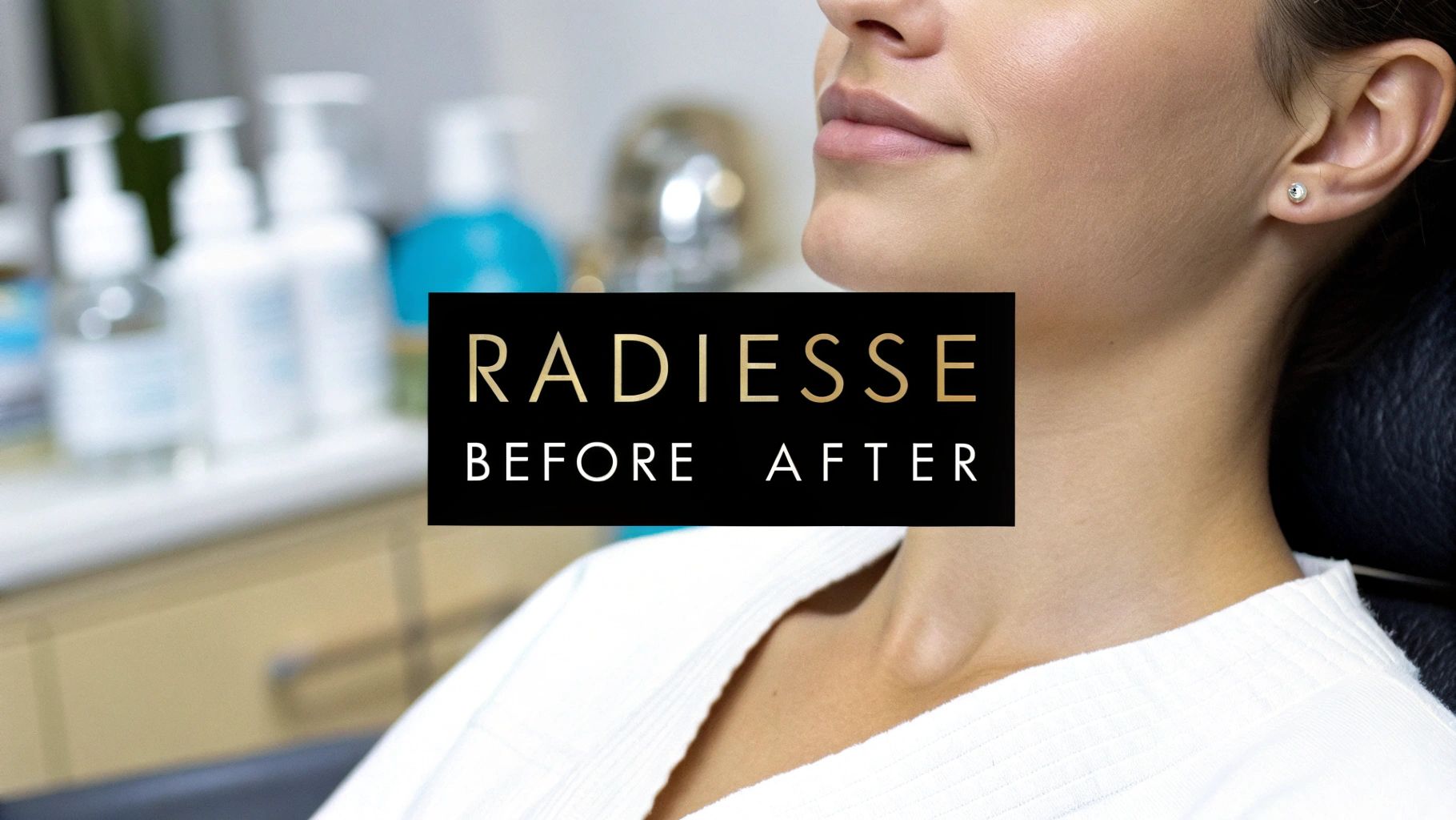 Radiesse Before and After: Real Transformations - radiesse before and after