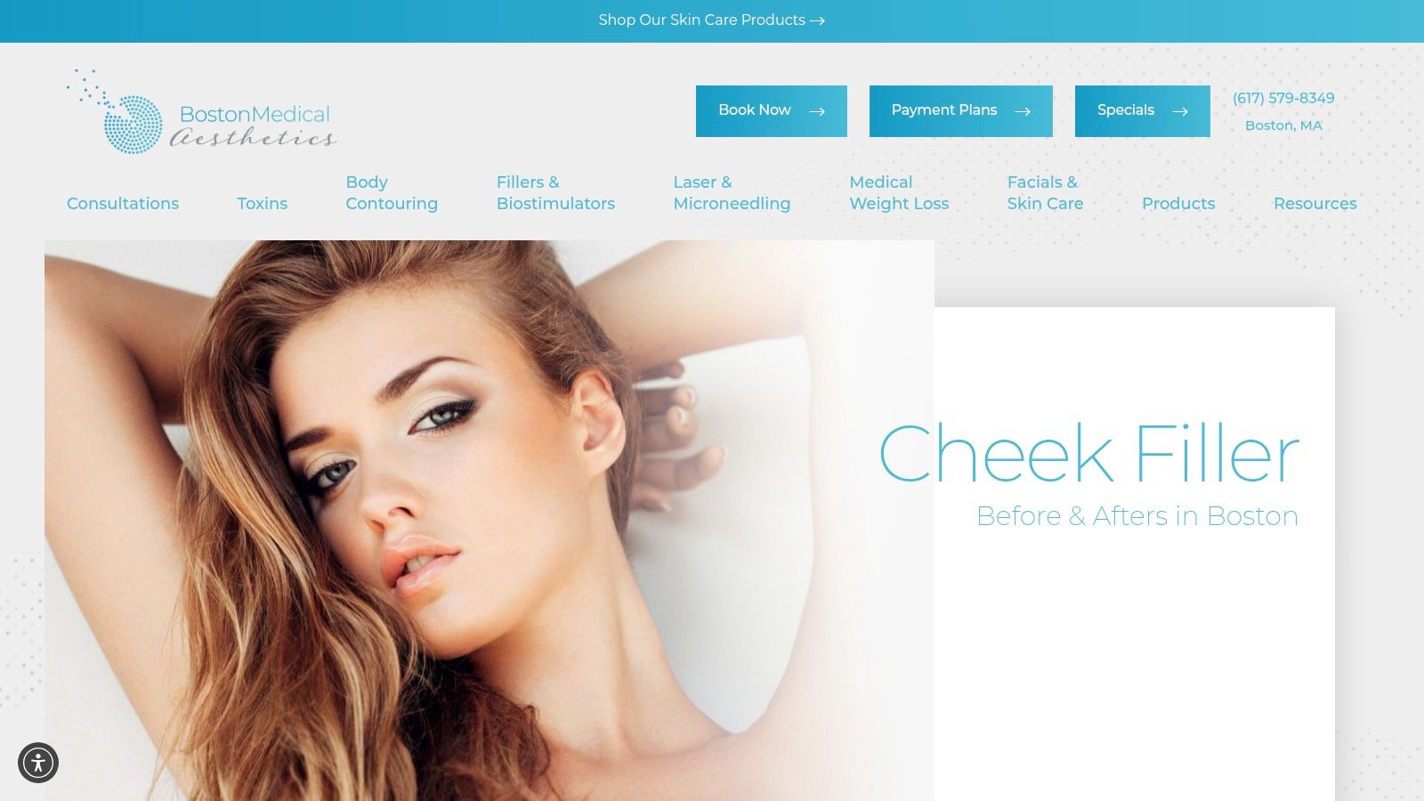 Boston Medical Aesthetics – Cheek Filler Before & After Gallery (Boston, MA)