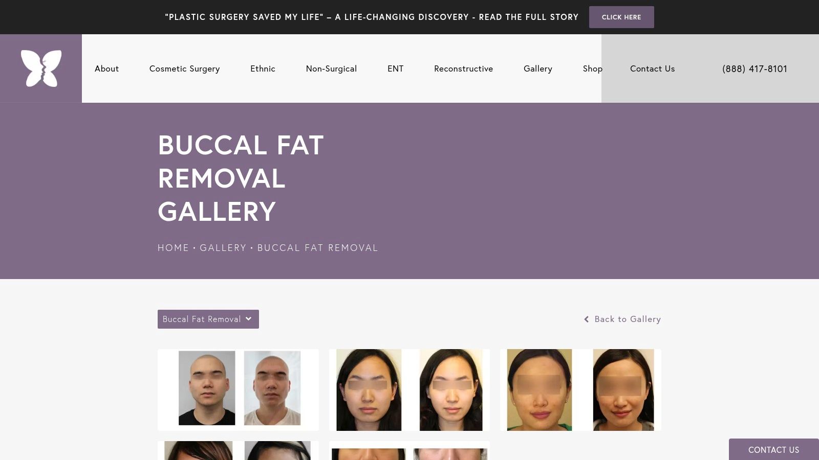 Dr. Kimberly Lee – Beverly Hills Facial Plastic Surgery Center