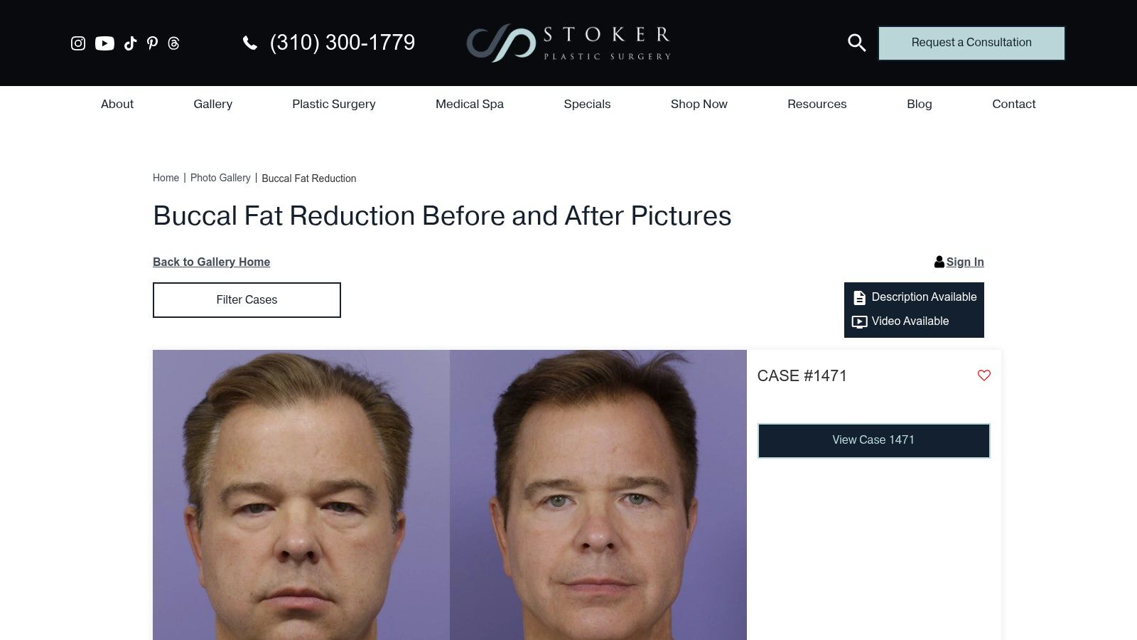 Stoker Aesthetics (Dr. David Stoker, MD)