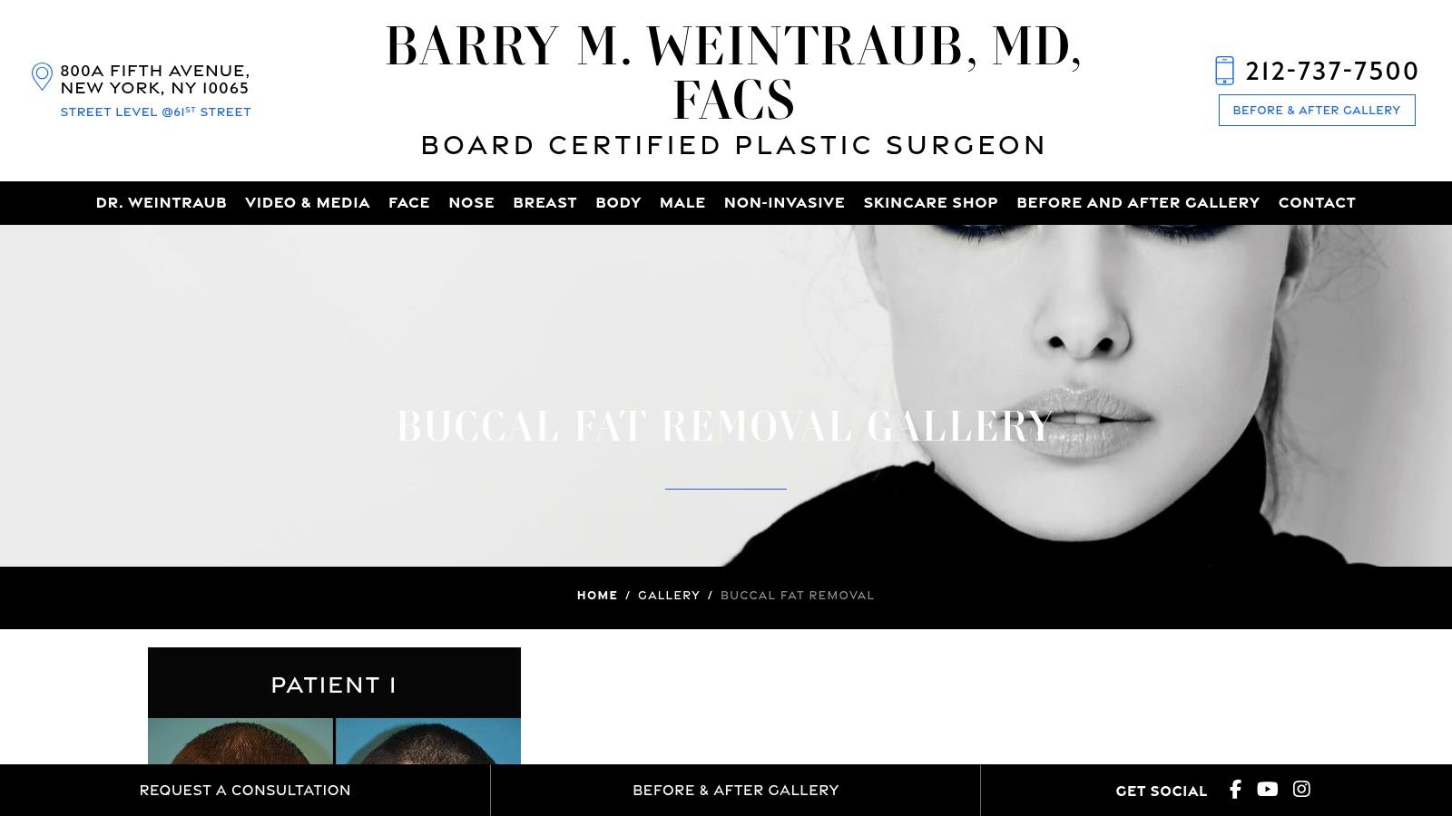 Dr. Barry Weintraub – NYC Plastic Surgeon