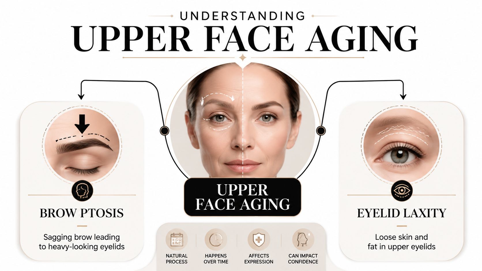 An infographic illustrating signs of upper face aging, specifically brow ptosis and eyelid laxity in a woman.