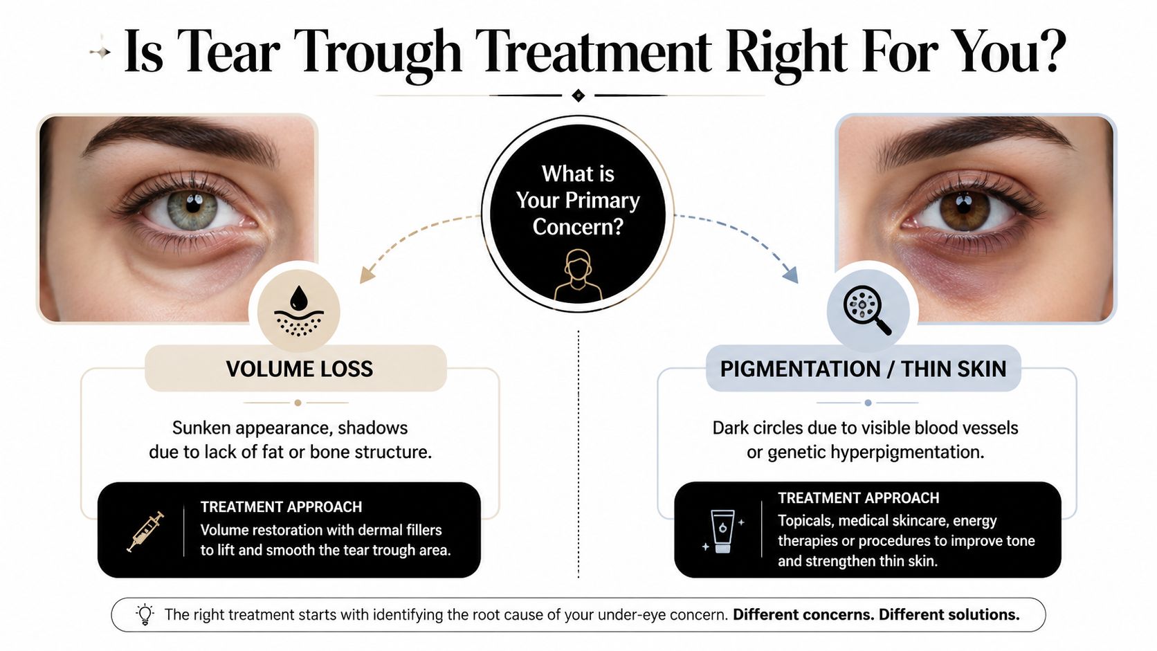 An infographic titled Is Tear Trough Treatment Right For You? detailing differences between volume loss and pigmentation.