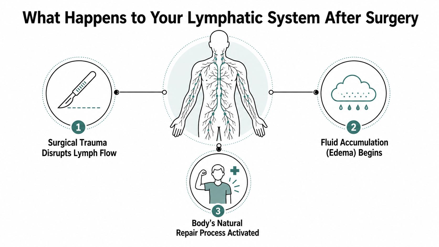 A diagram illustrating how surgical trauma impacts the lymphatic system, leading to fluid buildup and natural healing.