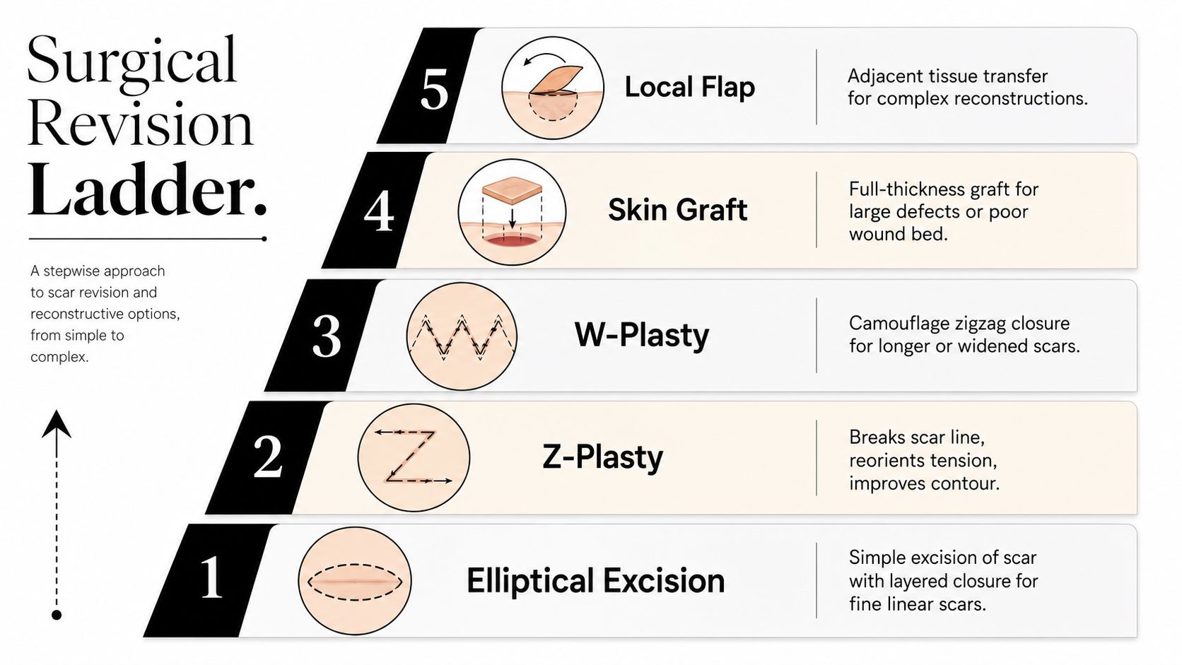 A diagram illustrating the Surgical Revision Ladder showing five steps for treating scars from simple to complex.