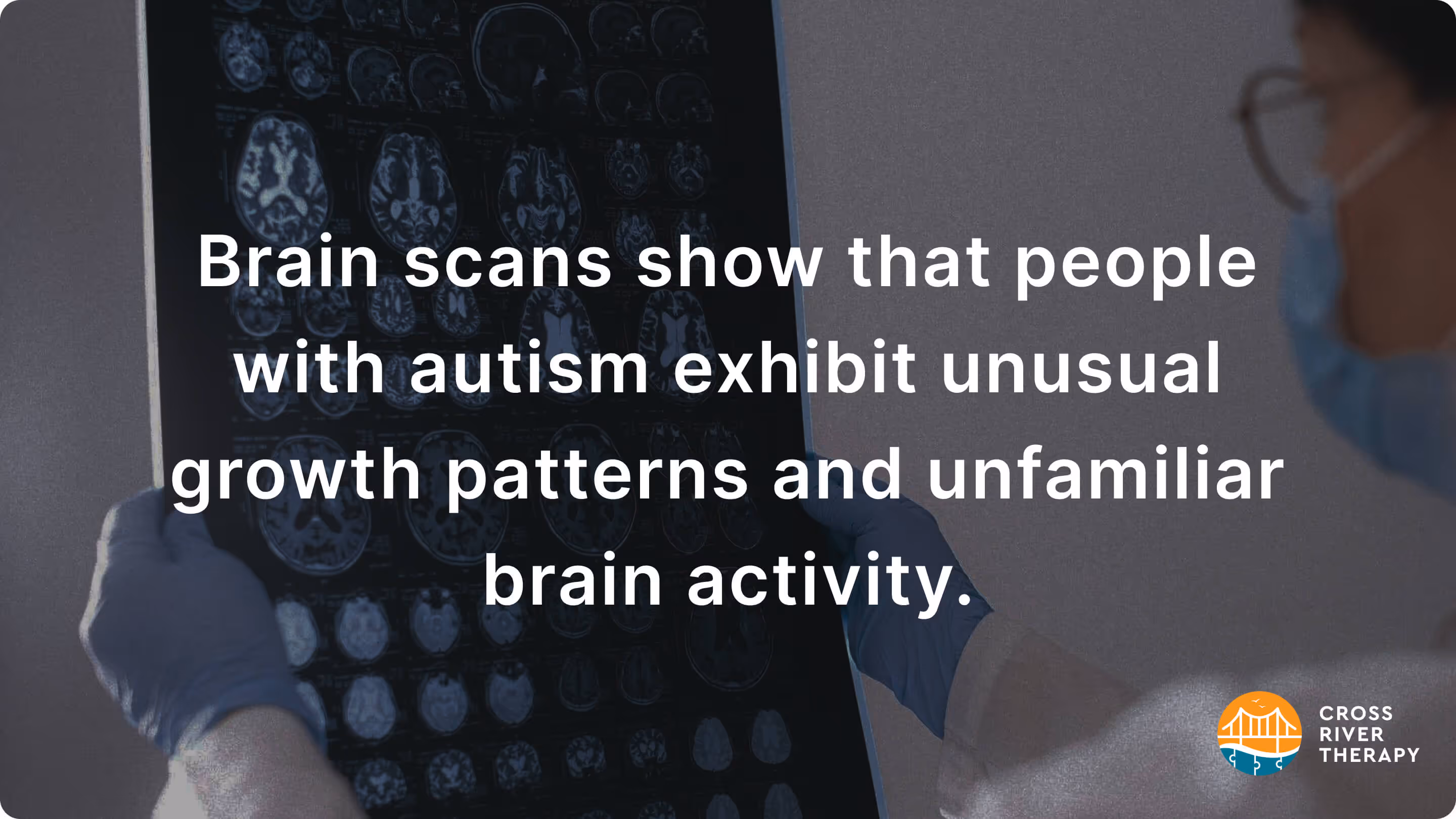 What Do Brain Scans Of Autistic People Show?