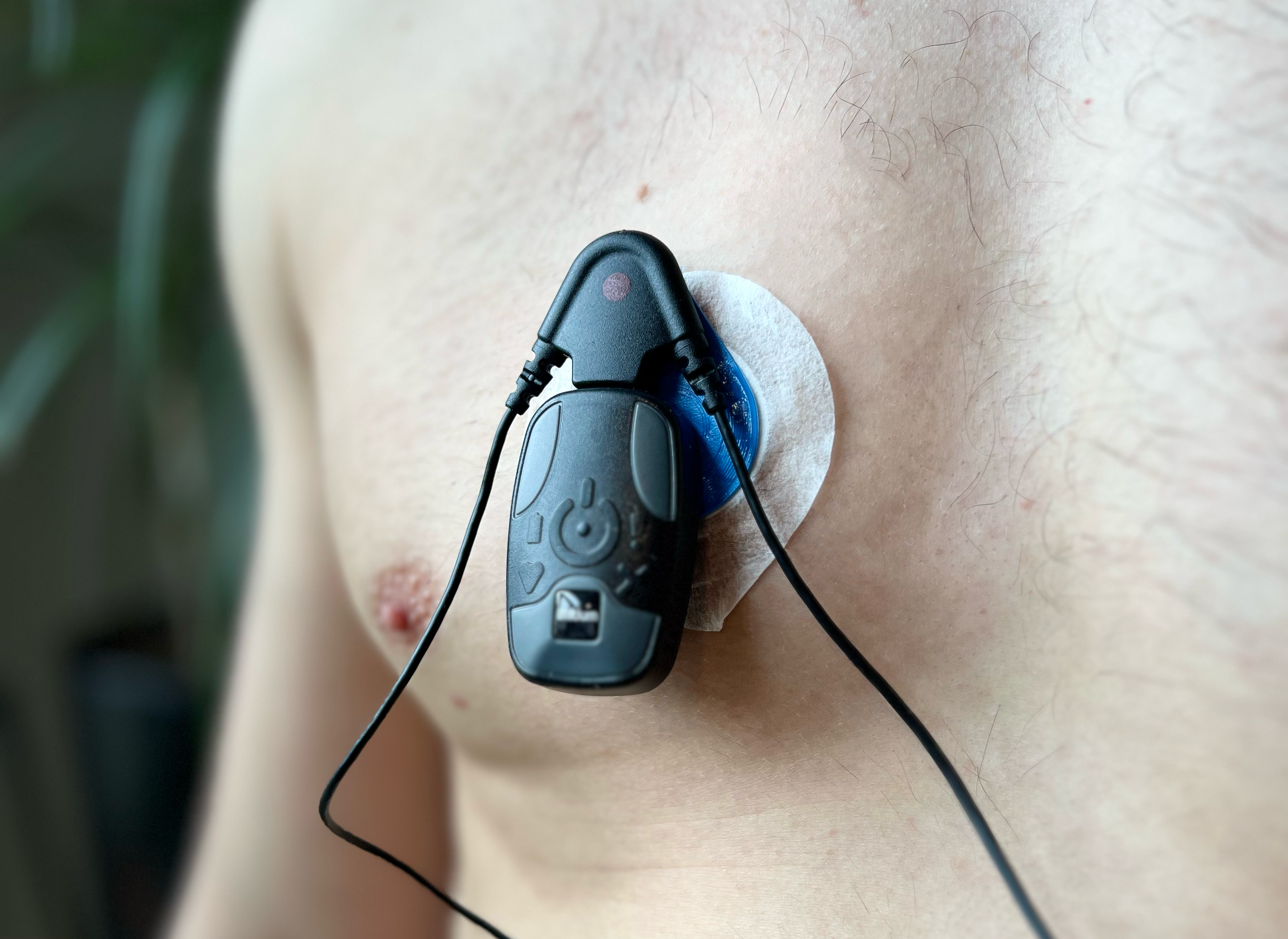 Thuisholter op de borst bij een paient