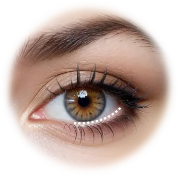 Mini Browlift