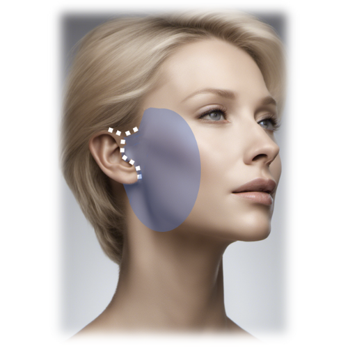 En Block Facelift