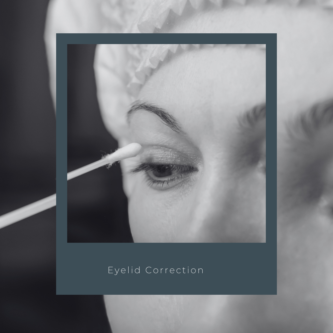 Procedure: Eyelid Correction