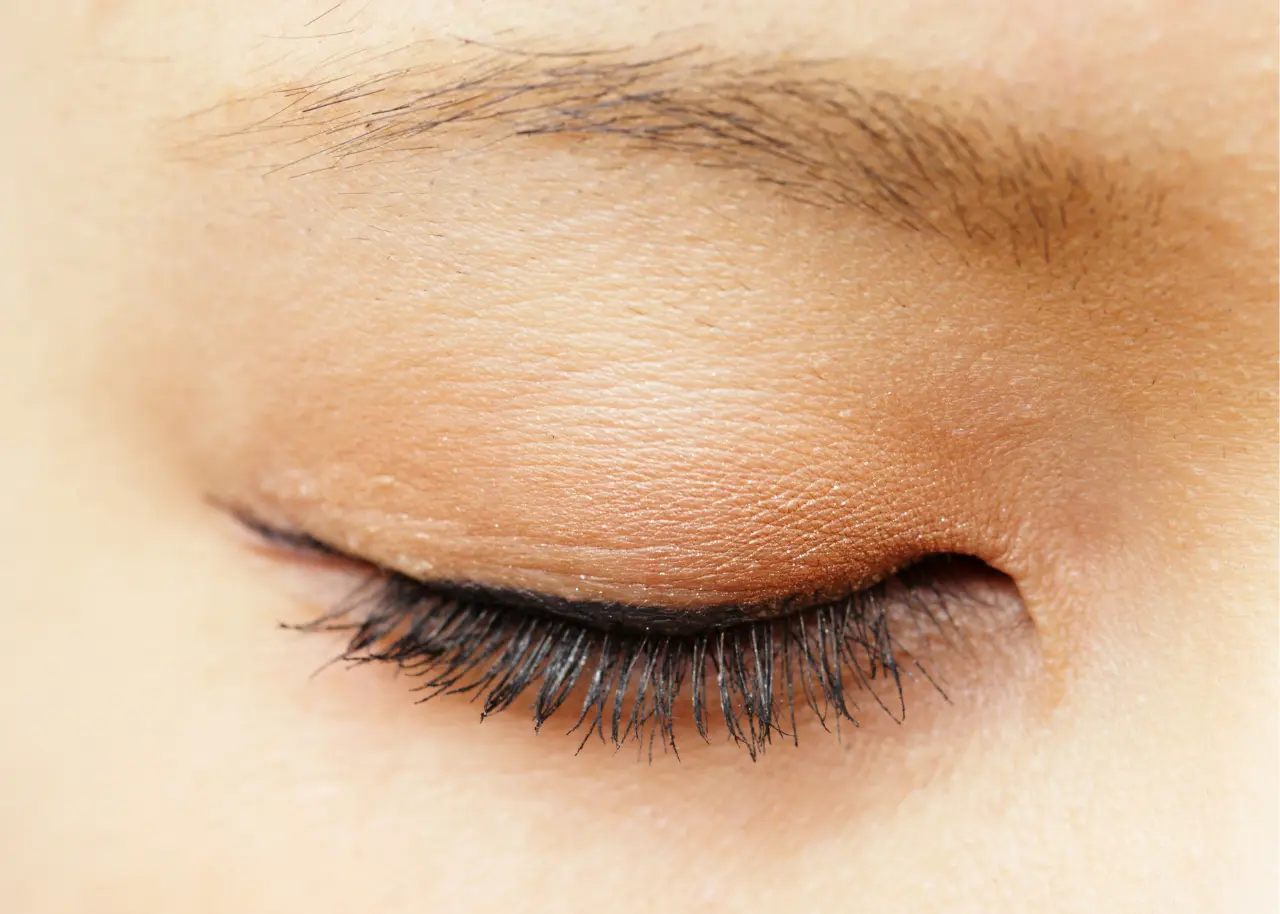 Eyelid Correction surgery