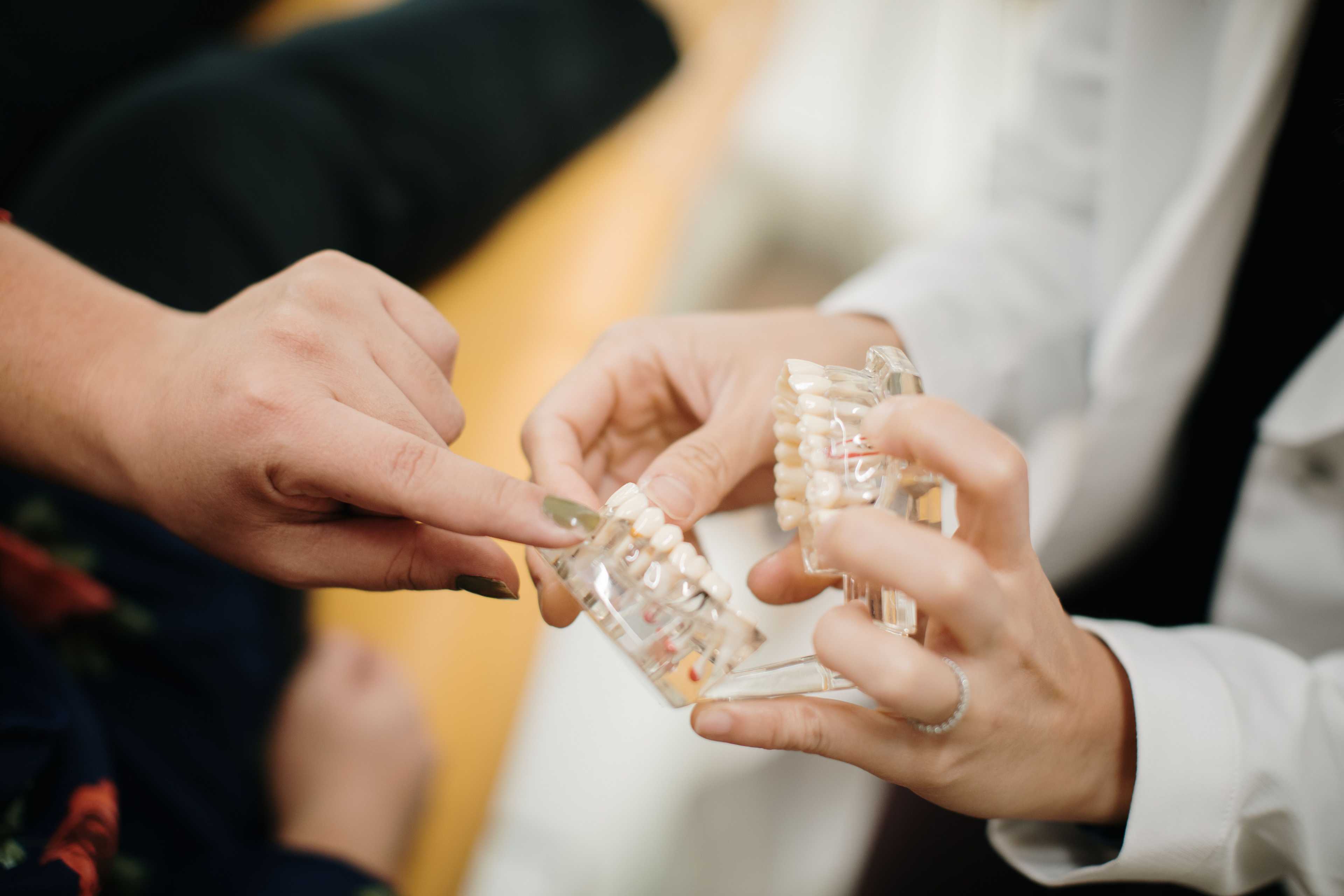 Mock teeth to educate what Porcelain Veneers are