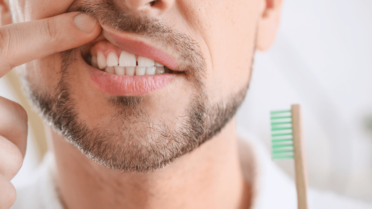 Photo of Cosmetic Gum Treatments