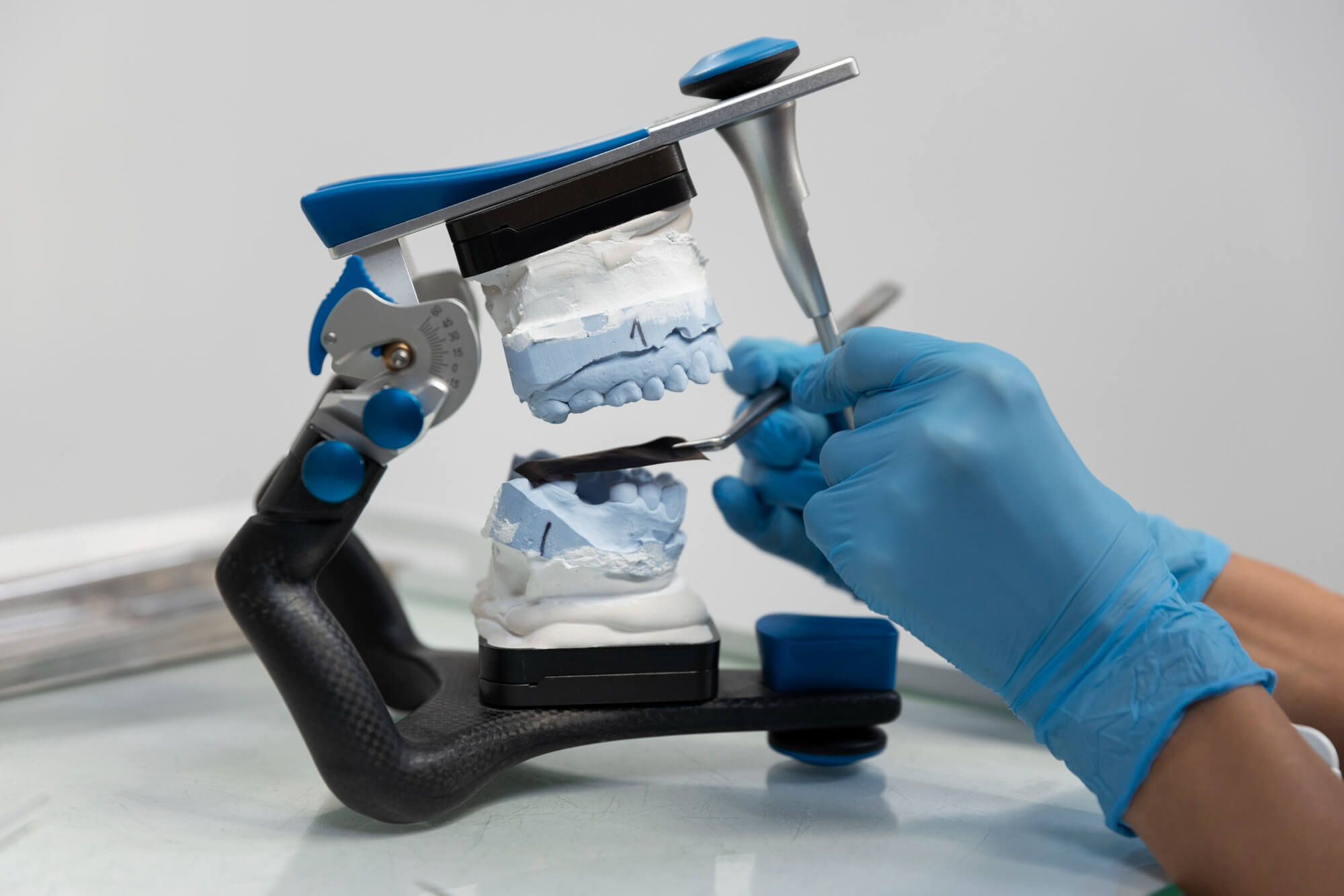 How 3D printing in dentistry is revolutionizing the field and what it means for the future of dental treatments.