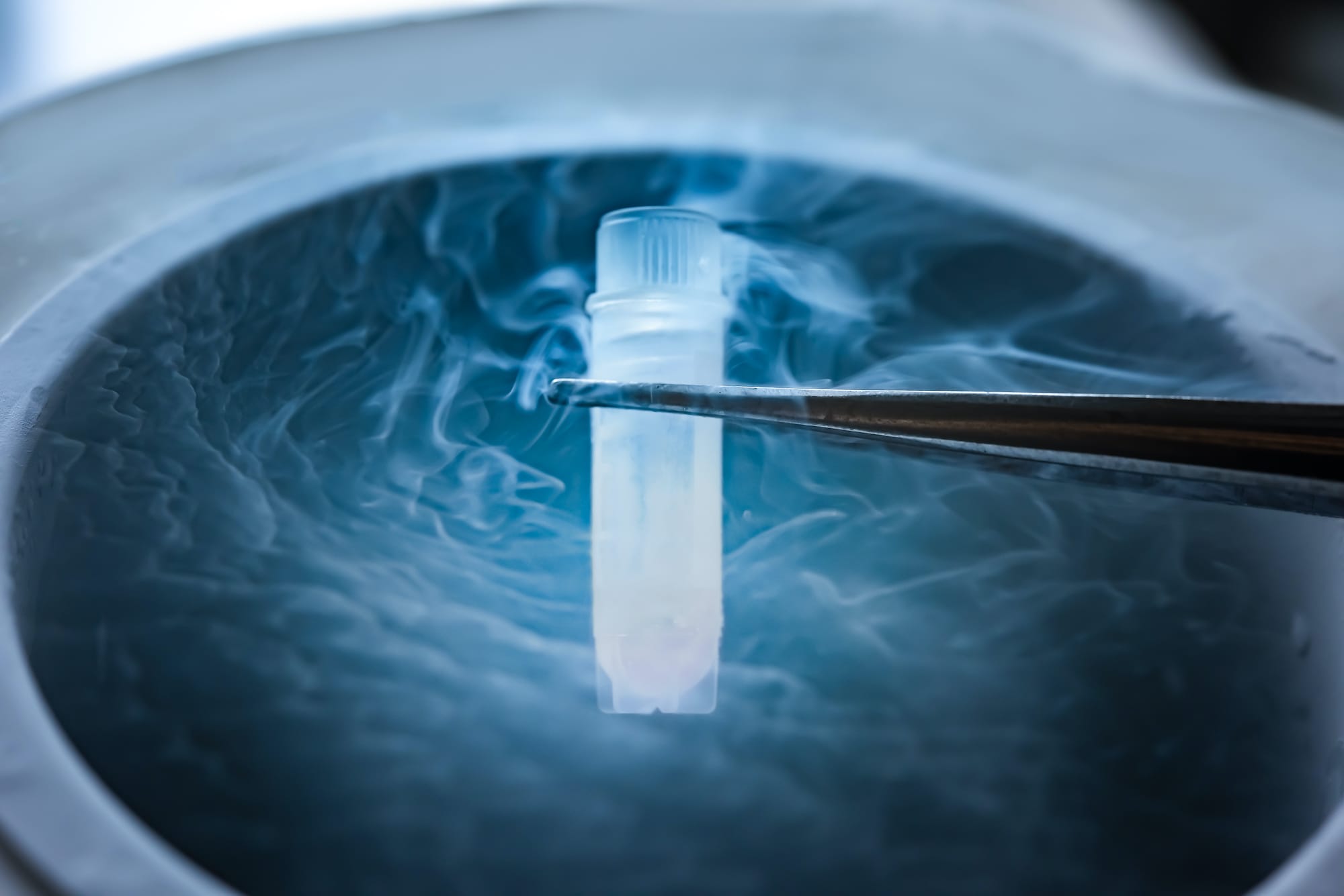 History of sperm freezing