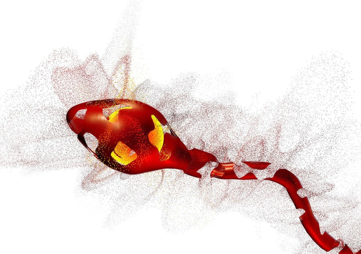 Oxidative stress and male fertility