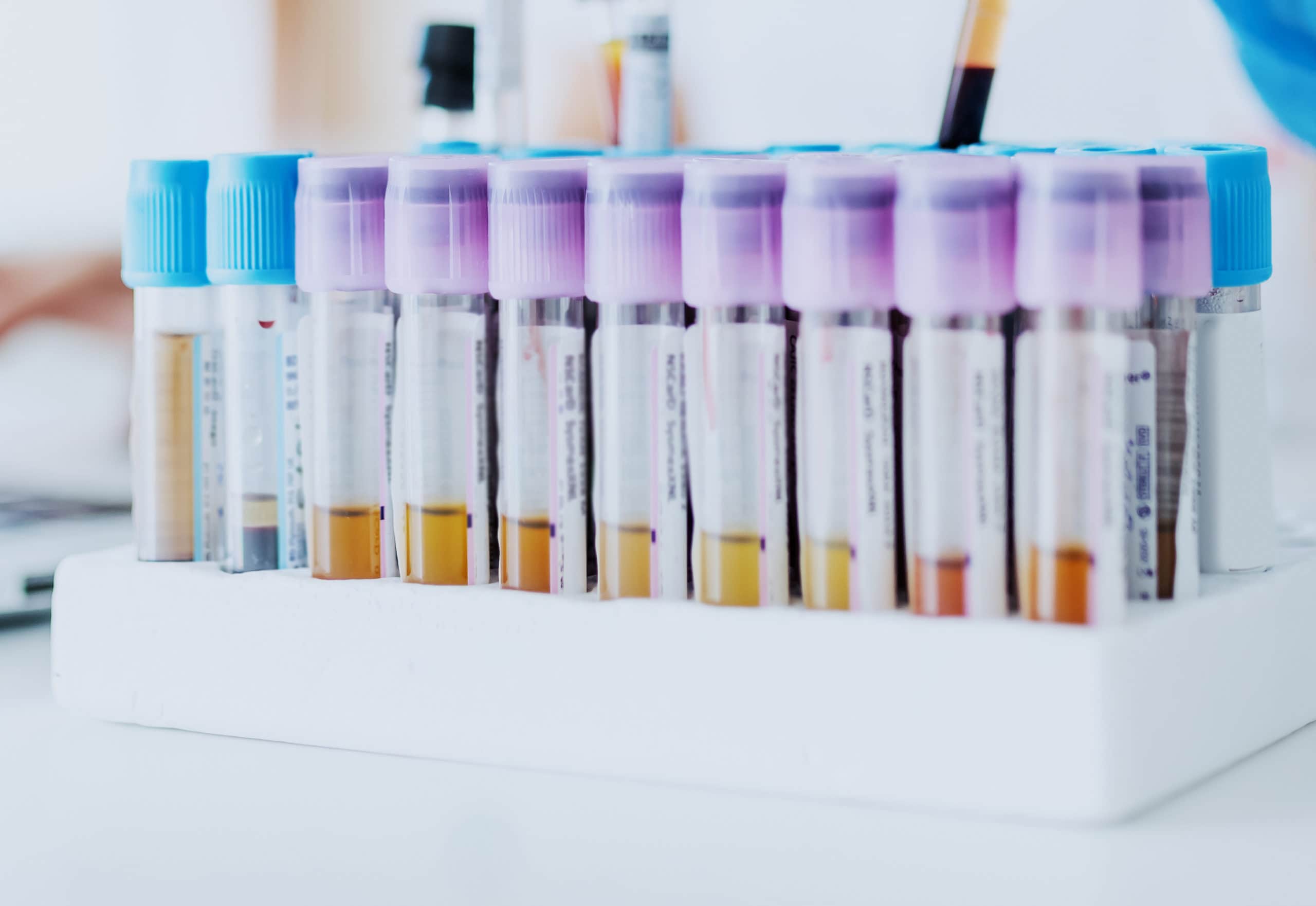 Hormone testing for male fertility