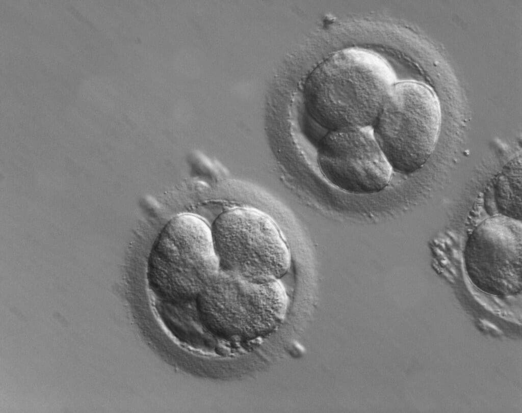 How sperm health affects embryo quality