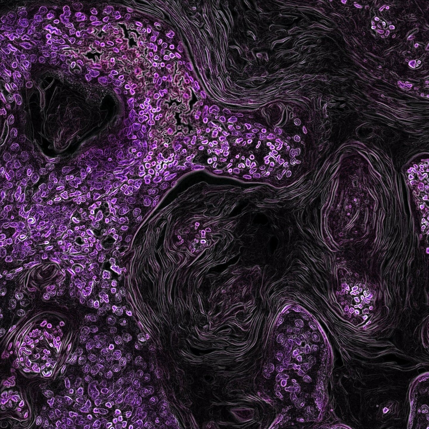 The undiscussed risks of cancer diagnosis and treatment: How cancer impacts male fertility