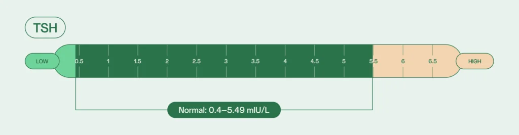 hyperthyroidism and male fertility: TSH normal levels 0.4–5.49 mIU/L