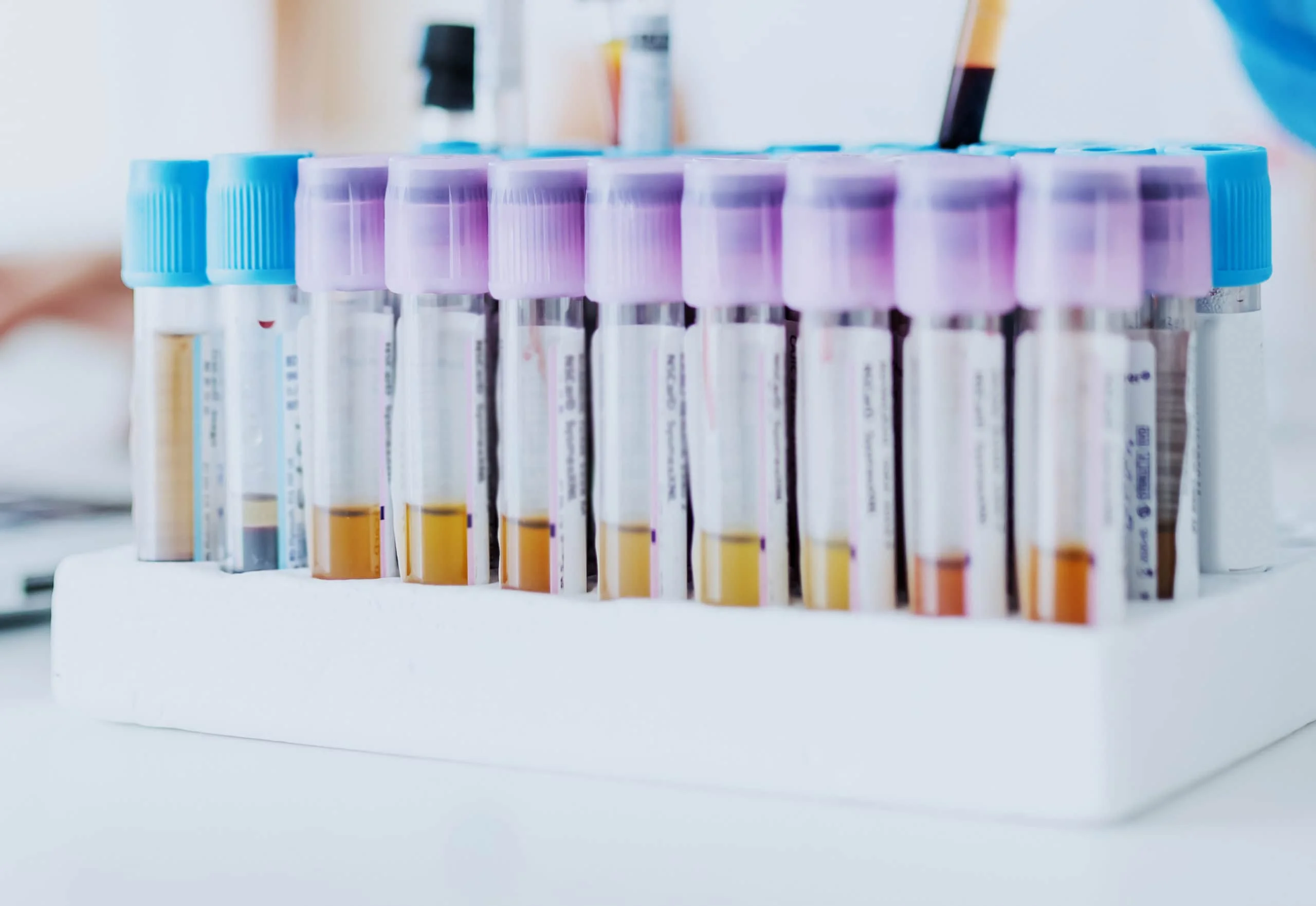 Hormone testing for male fertility
