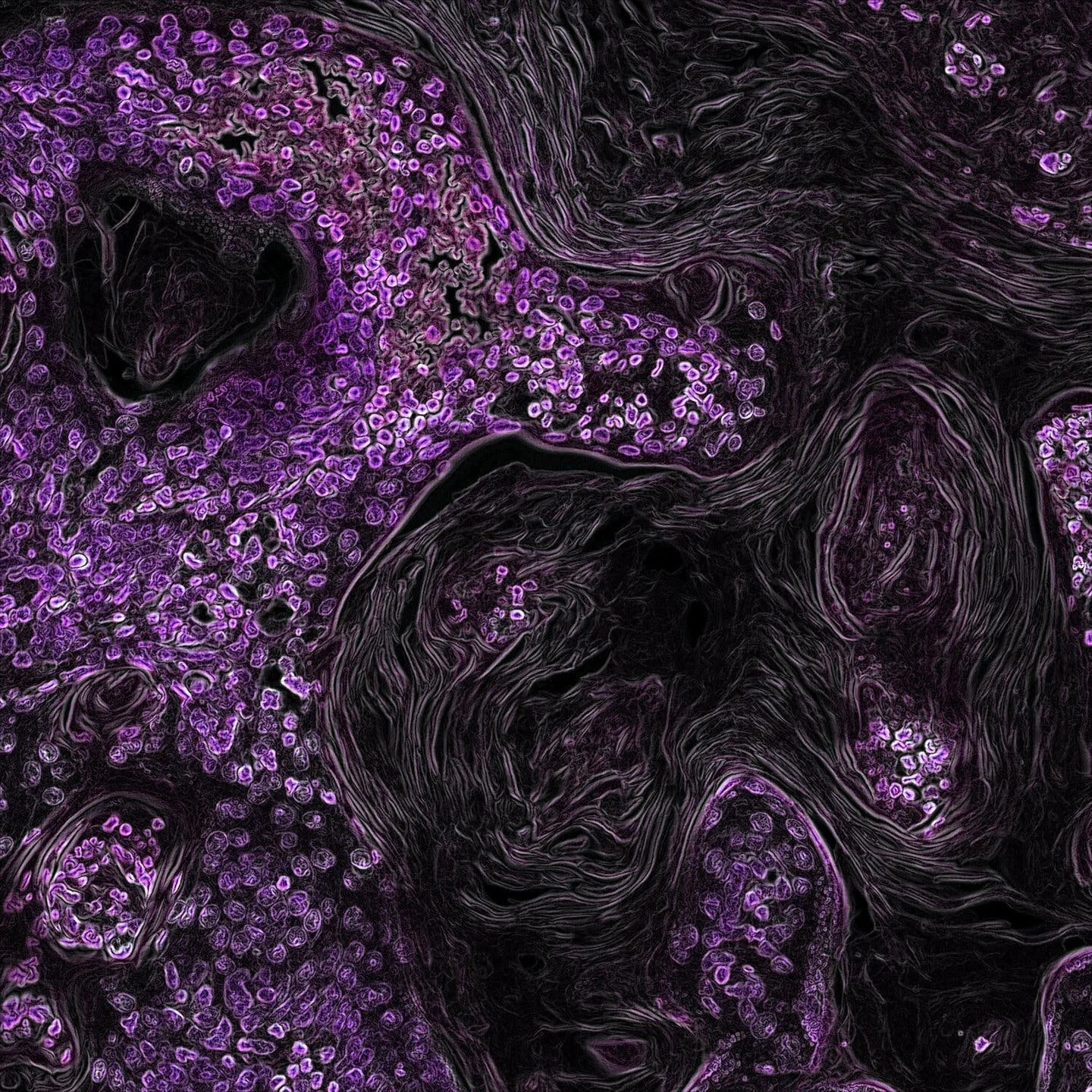 The undiscussed risks of cancer diagnosis and treatment: How cancer impacts male fertility