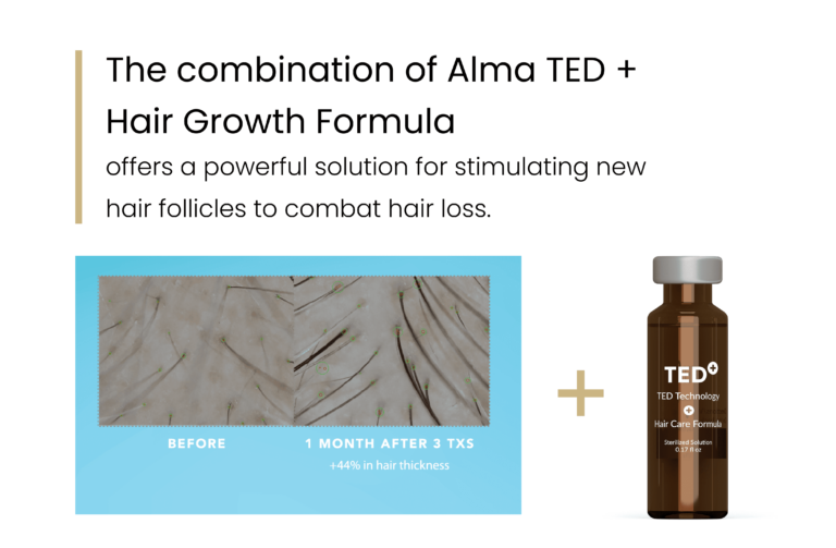 Hair Growth