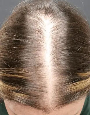 Before and after images