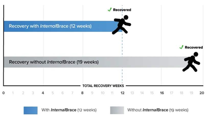 Comparison chart showing recovery time with InternalBrace versus without: 12 weeks with InternalBrace and 19 weeks without, highlighting faster ankle injury recovery.