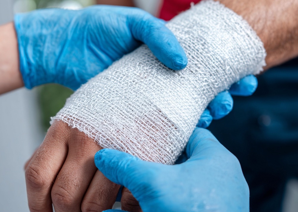 Kansas City burn injury attorney representing victims of severe burns and accidents