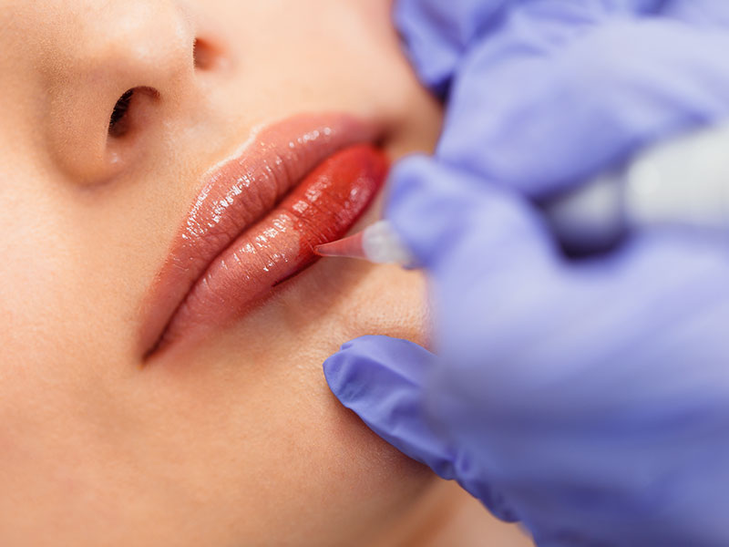 Pigmentacja Ust w Holistic Med Clinic / Aleksandra Nowak