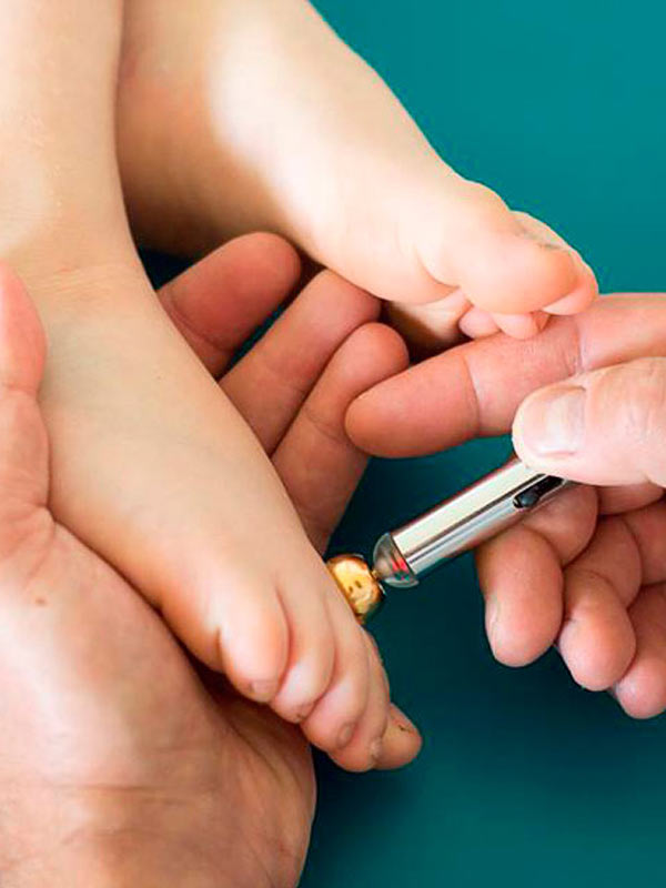 Elektropunktura w HOLISTIC MED™