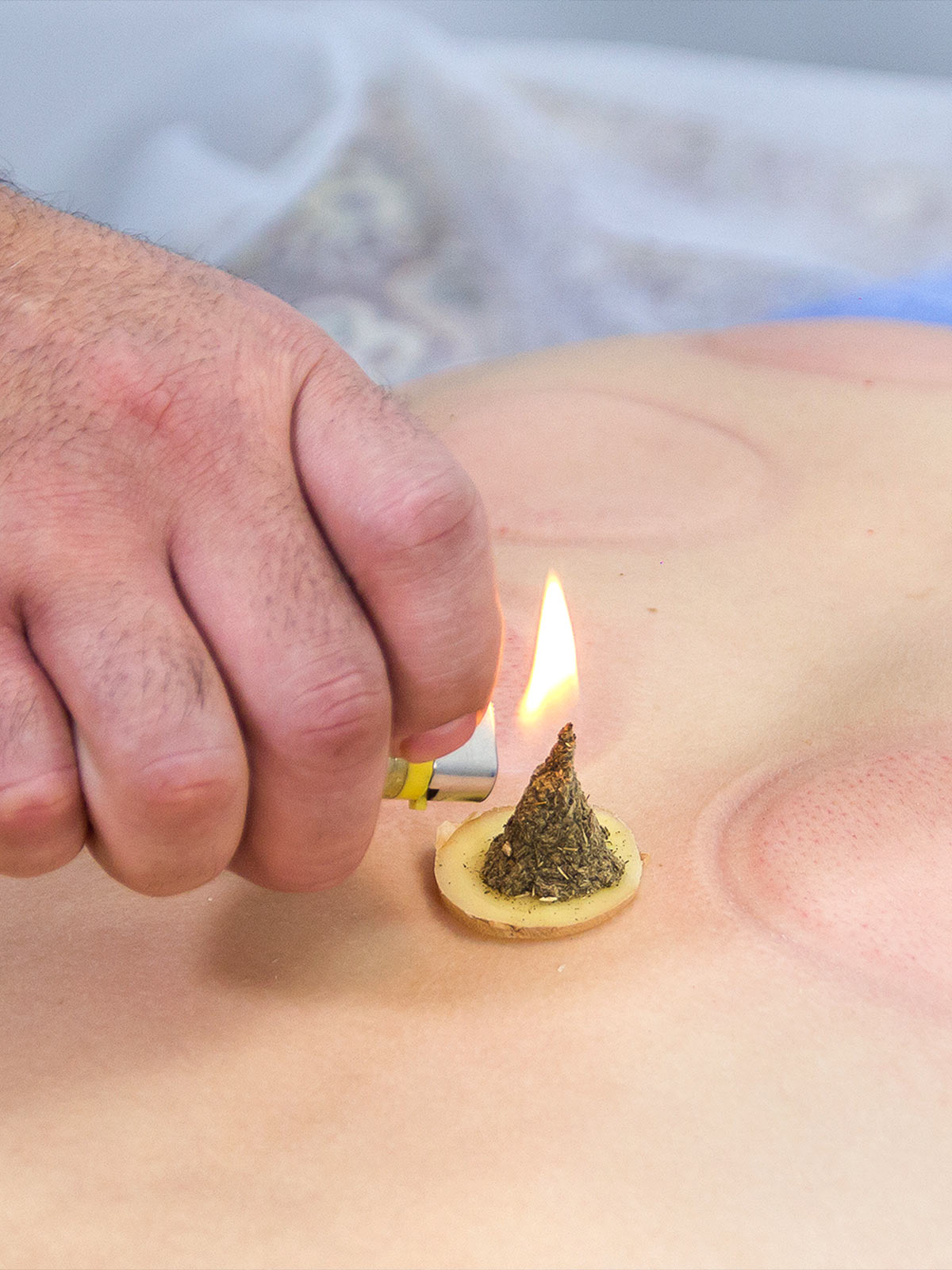 Moksoterapia w HOLISTIC MED™