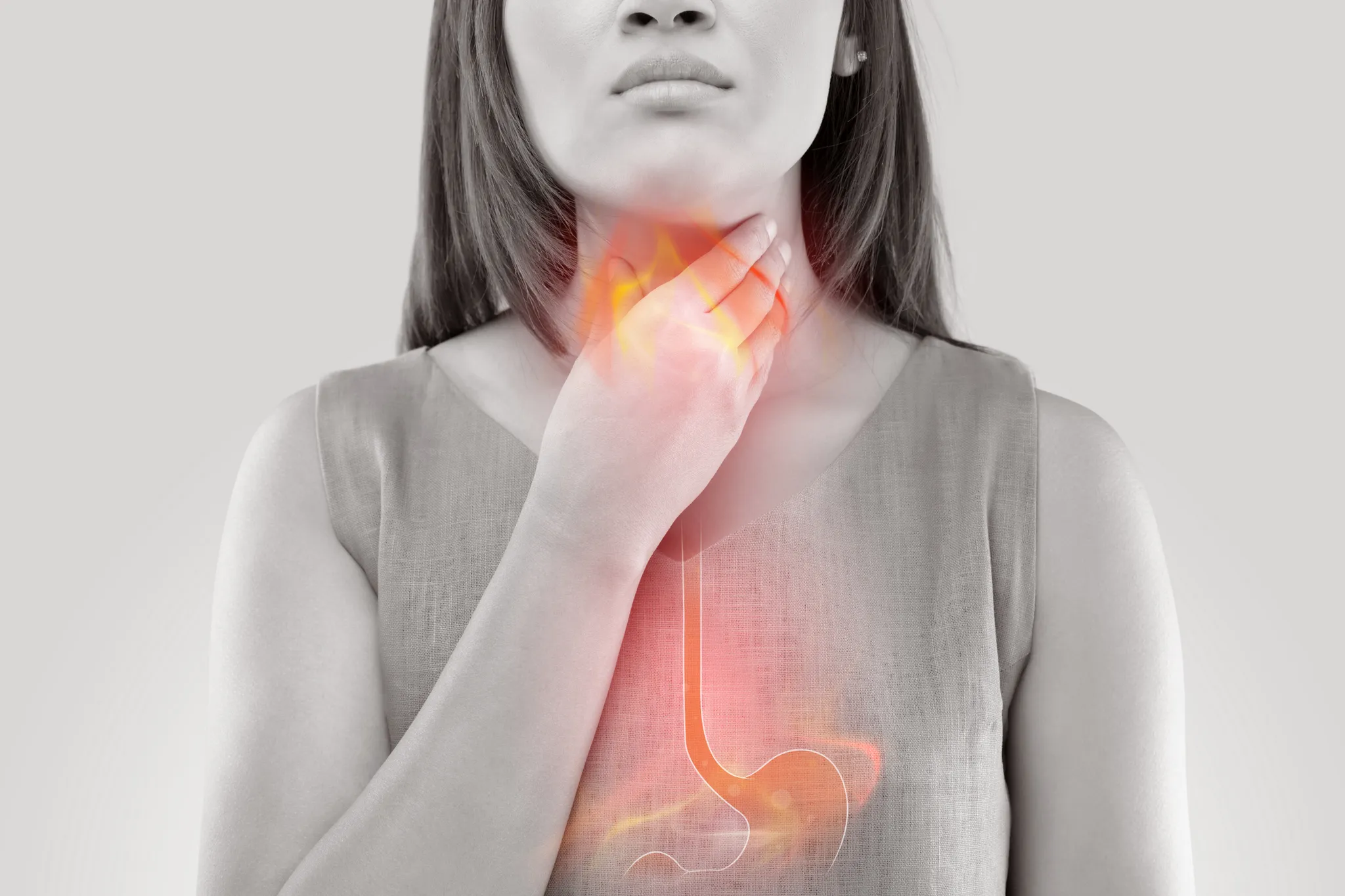 Women with acid reflux / GORD
