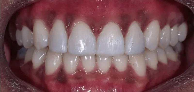 Close-up of healthy, white, aligned teeth with shiny enamel
