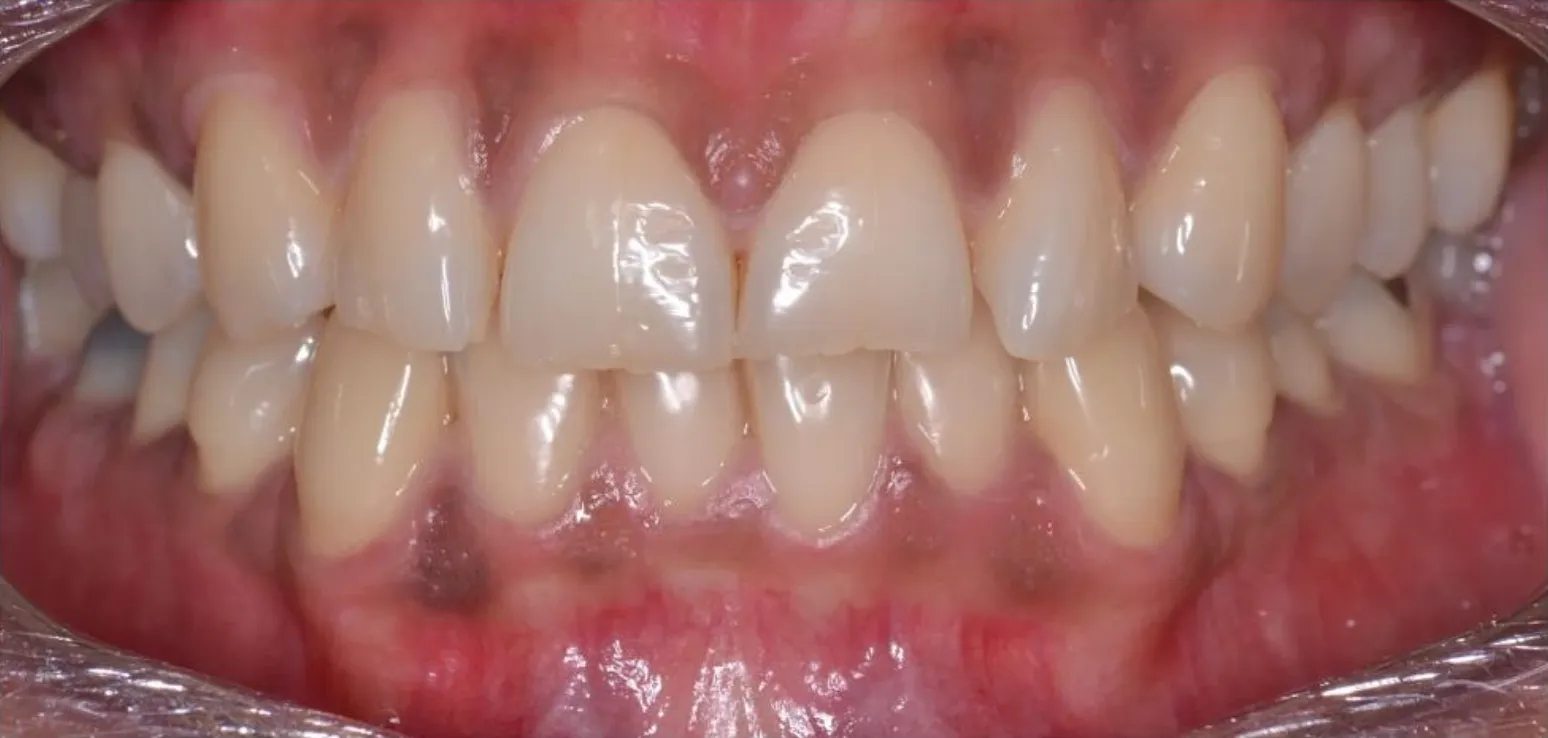Close-up of healthy, clean teeth with pink gums and smooth enamel