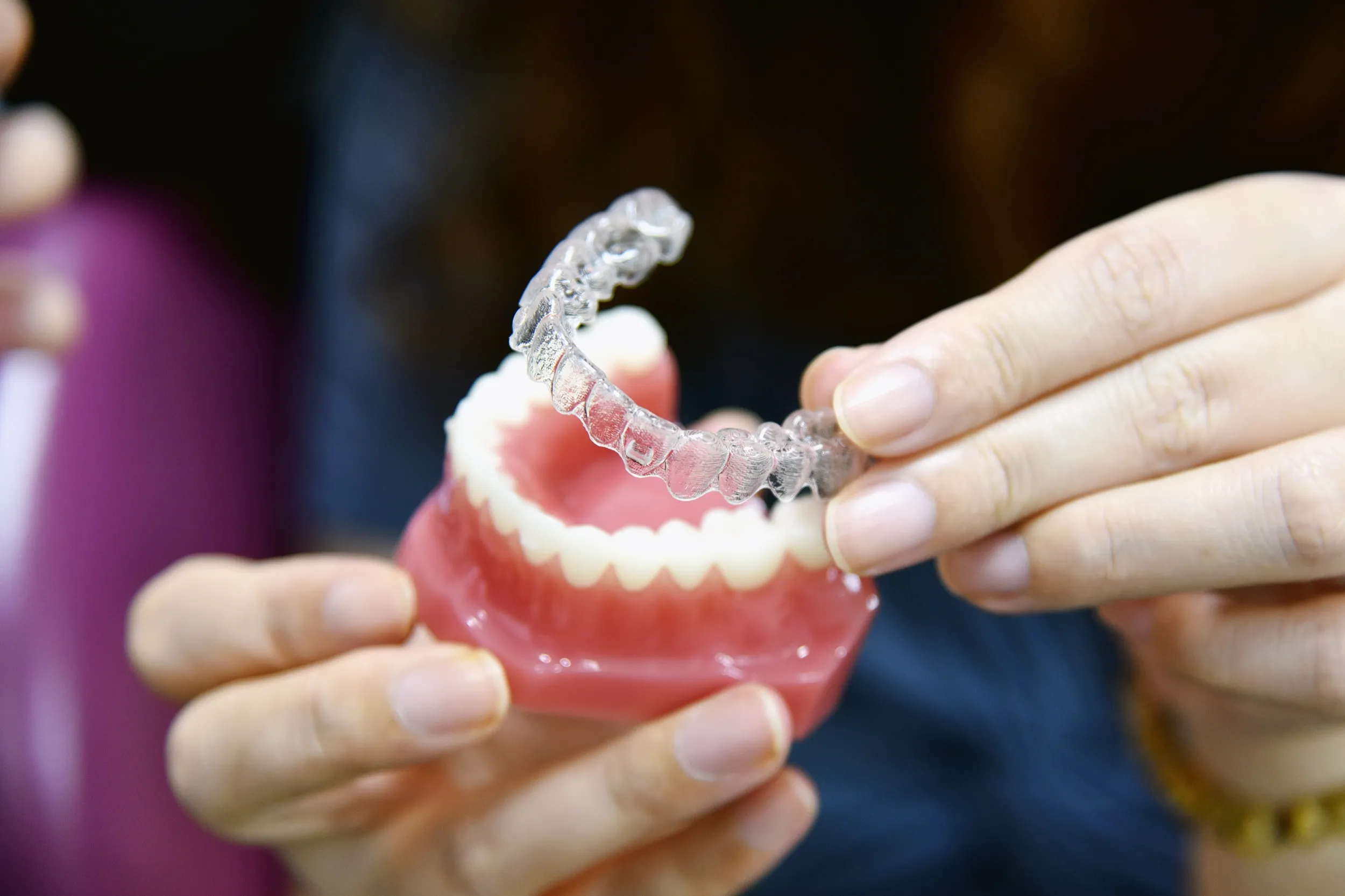 Clear dental aligners being held over a model of teeth